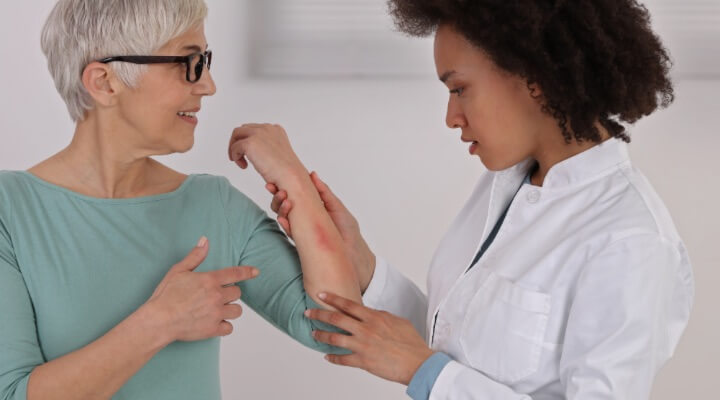 dermatologist examining psoriasis on arm